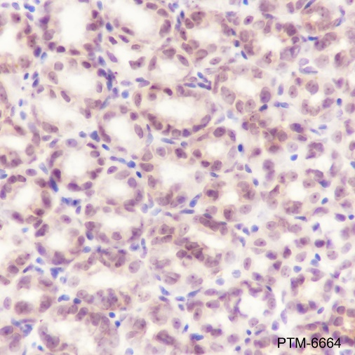 Anti-Cyclin D2 Rabbit mAb