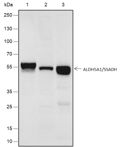 Anti-ALDH5A1/SSADH Rabbit mAb