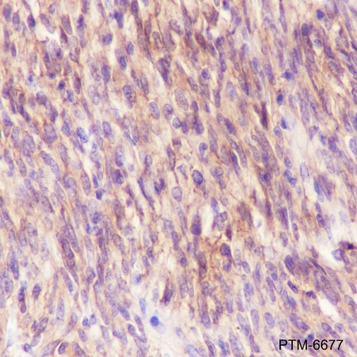Anti-c-Kit Rabbit mAb
