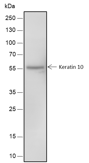 Anti-Keratin 10 Rabbit mAb