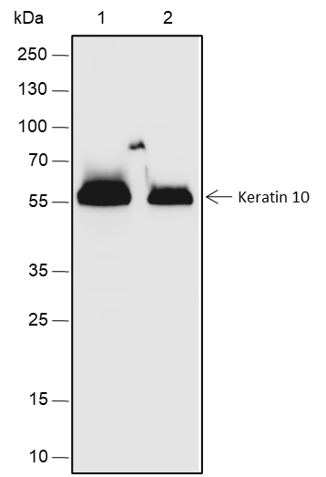 Anti-Keratin 10 Rabbit mAb