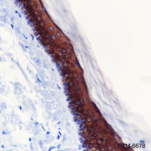 Anti-Keratin 10 Rabbit mAb