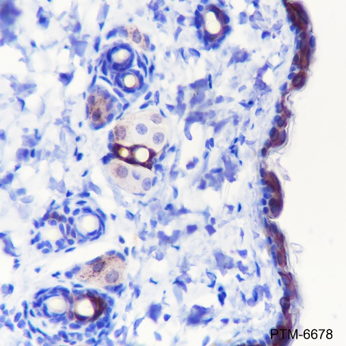 Anti-Keratin 10 Rabbit mAb