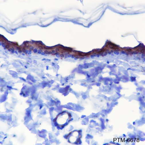 Anti-Keratin 10 Rabbit mAb