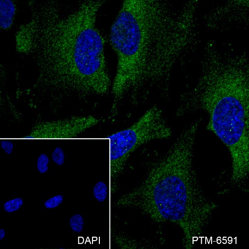 Anti-IkB beta Rabbit mAb