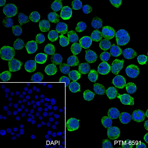 Anti-IkB beta Rabbit mAb