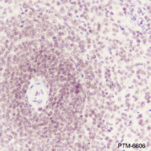 Anti-ATF1 Rabbit mAb