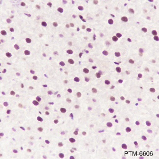 Anti-ATF1 Rabbit mAb
