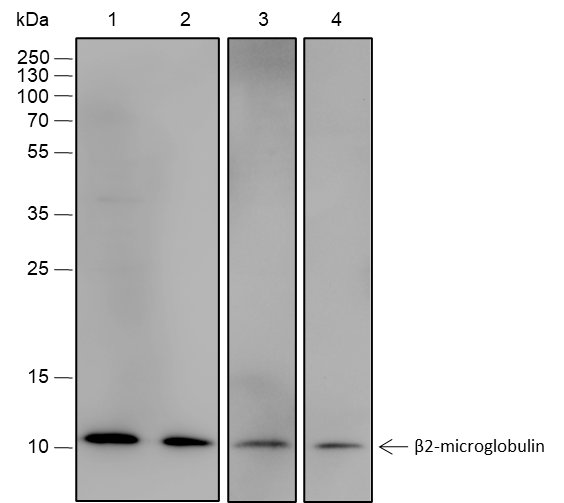 Anti-beta-2-Microglobulin Rabbit mAb