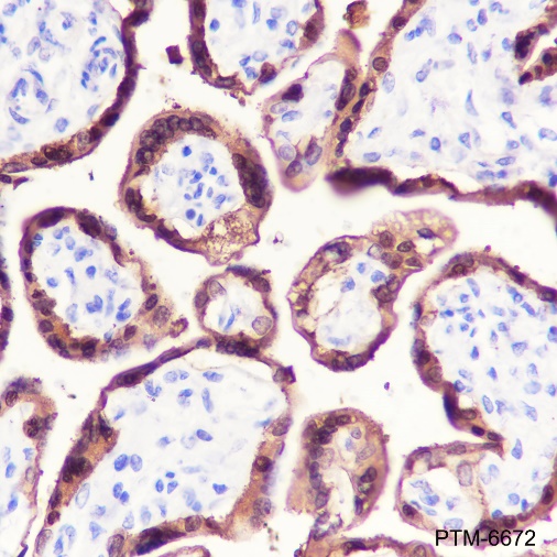Anti-HSD17B1 Rabbit mAb