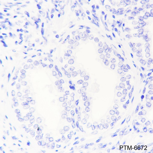 Anti-HSD17B1 Rabbit mAb