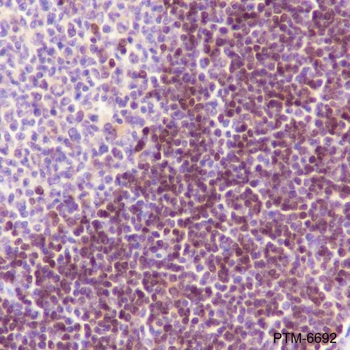 Anti-ADK Rabbit mAb
