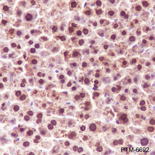 Anti-ADK Rabbit mAb