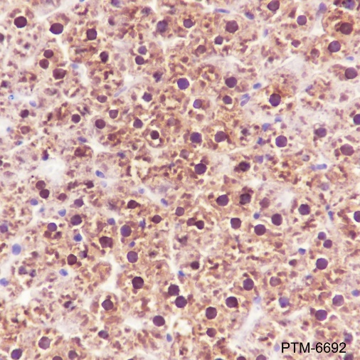 Anti-ADK Rabbit mAb