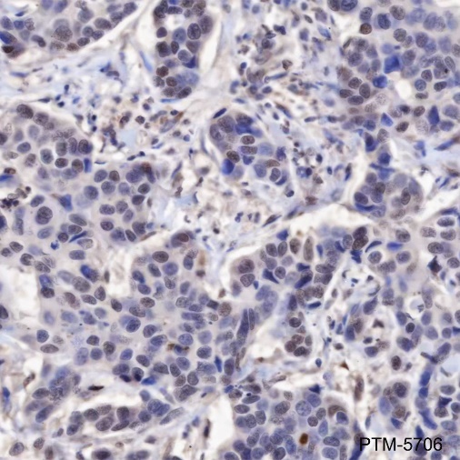 Anti-NF-kB1 p105/p50 Mouse mAb