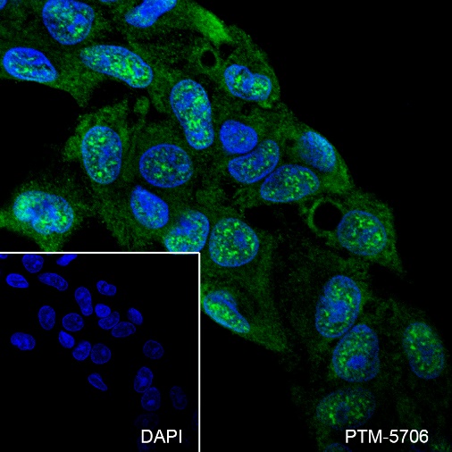 Anti-NF-kB1 p105/p50 Mouse mAb