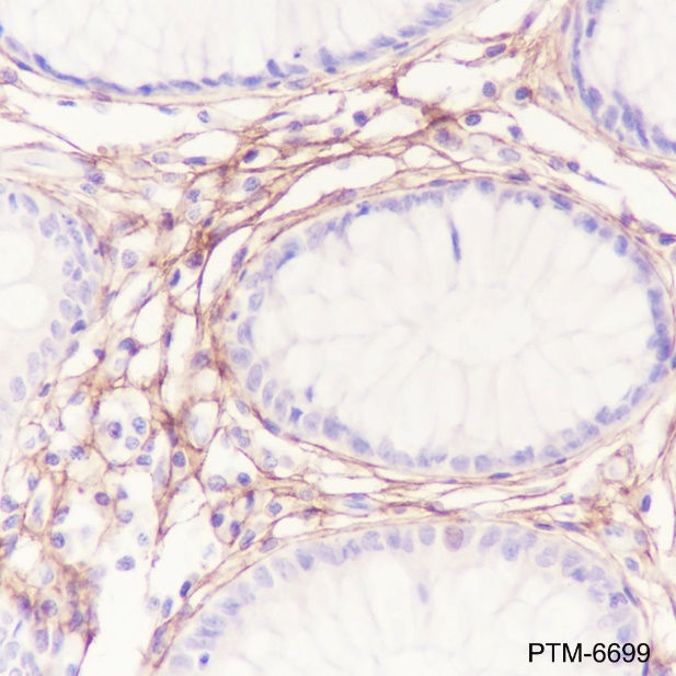 Anti-Periostin Mouse mAb
