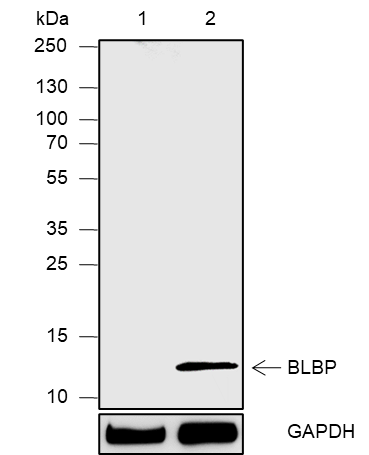 Anti-FABP7 Rabbit mAb