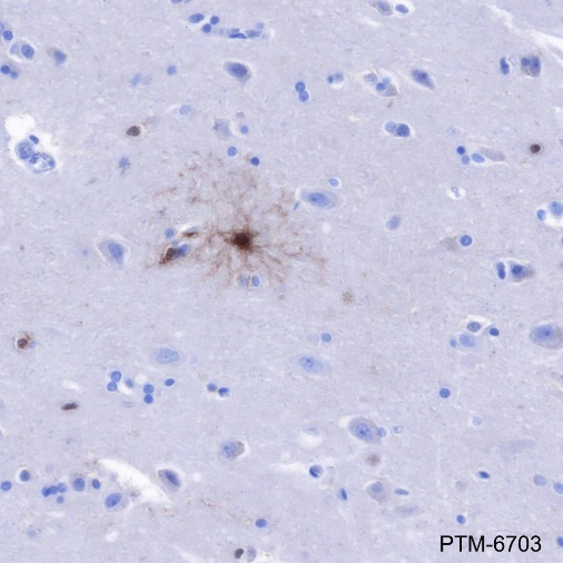 Anti-FABP7 Rabbit mAb