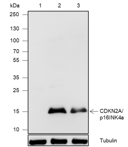 Anti-CDKN2A/p16INK4a Rabbit mAb