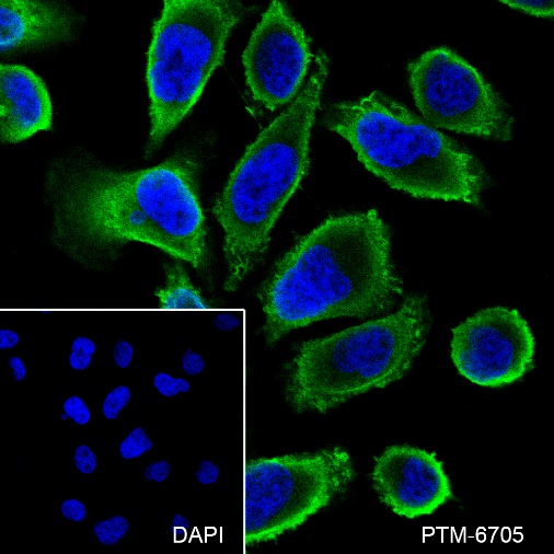 Anti-Cdc42 Rabbit mAb