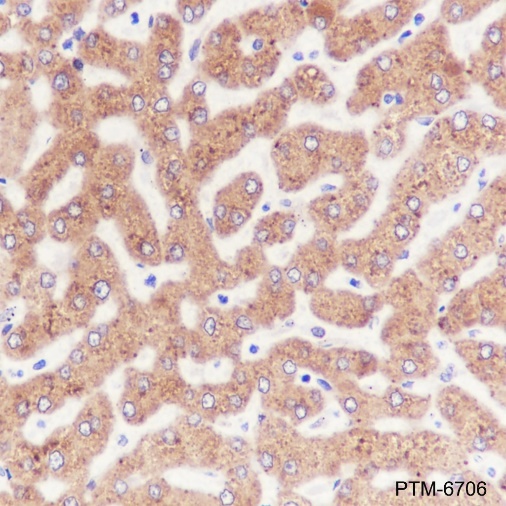 Anti-METTL7A Mouse mAb