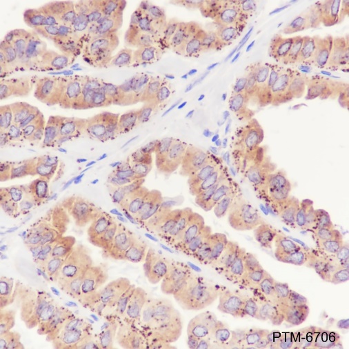 Anti-METTL7A Mouse mAb
