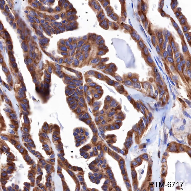 Anti-IGF2R/CI-M6PR Rabbit mAb