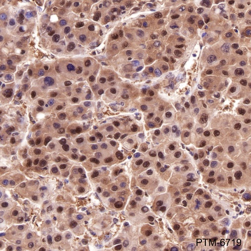 Anti-PSMA3 Mouse mAb