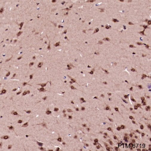 Anti-PSMA3 Mouse mAb