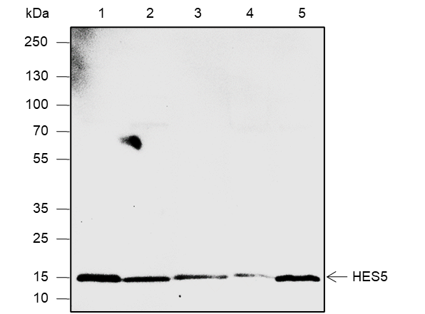 Anti-HES5 Rabbit mAb