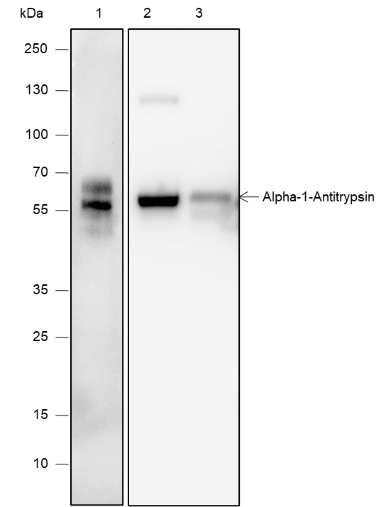 Anti-alpha 1 Antitrypsin Mouse mAb