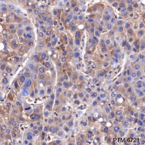 Anti-alpha 1 Antitrypsin Mouse mAb