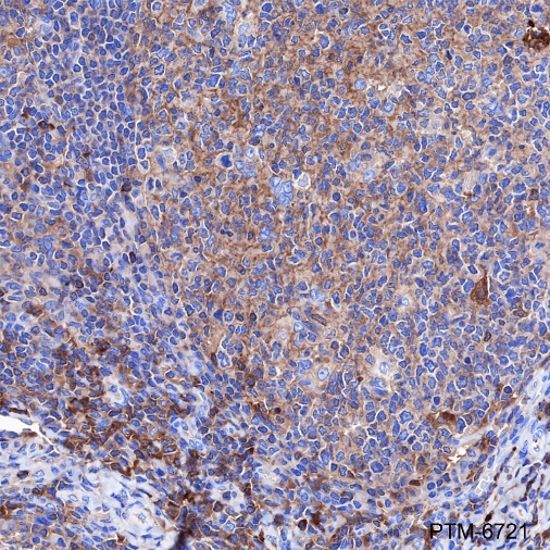 Anti-alpha 1 Antitrypsin Mouse mAb