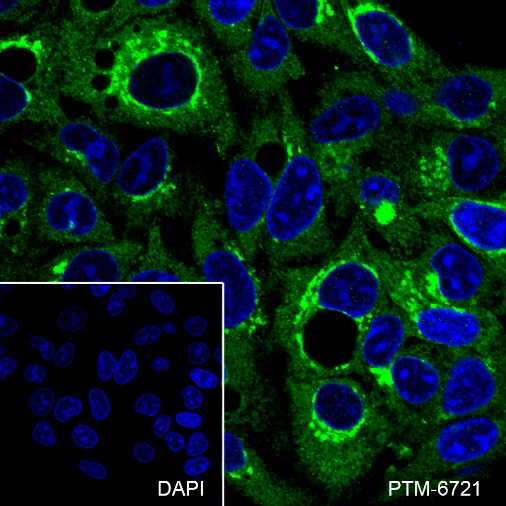 Anti-alpha 1 Antitrypsin Mouse mAb