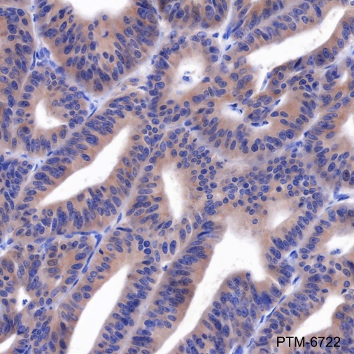 Anti-Rab5A Mouse mAb