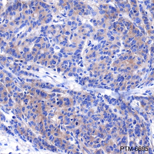 Anti-DR5 Rabbit mAb