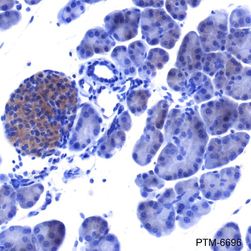 Anti-IRAK1 Rabbit mAb
