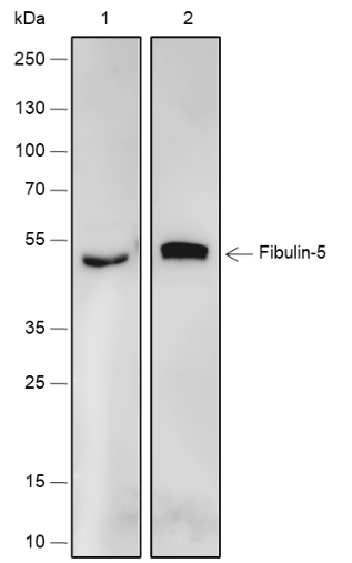 Anti-Fibulin-5 Rabbit mAb