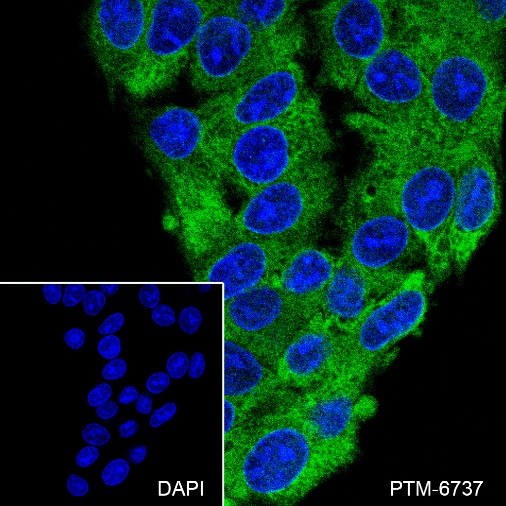 Anti-GART Mouse mAb