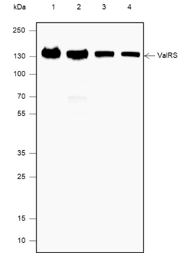Anti-Valyl tRNA Synthetase Mouse mAb