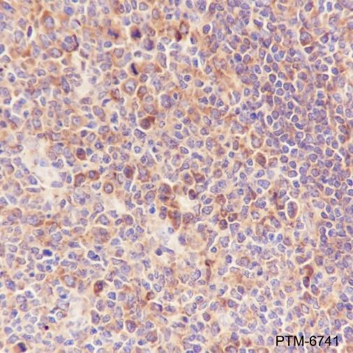 Anti-Valyl tRNA Synthetase Mouse mAb
