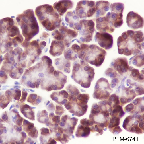 Anti-Valyl tRNA Synthetase Mouse mAb