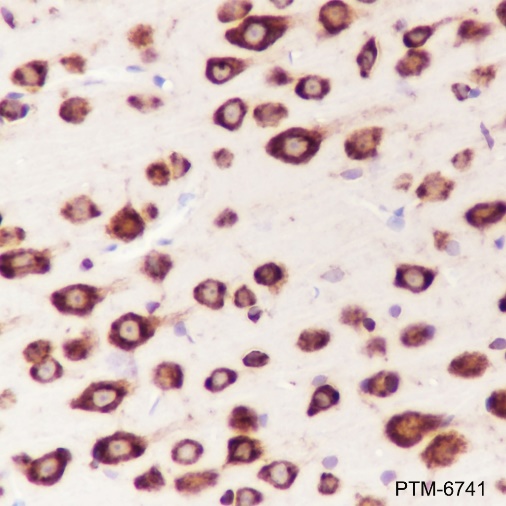 Anti-Valyl tRNA Synthetase Mouse mAb