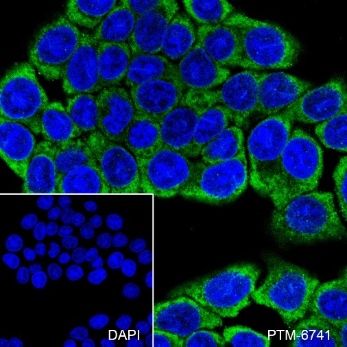 Anti-Valyl tRNA Synthetase Mouse mAb