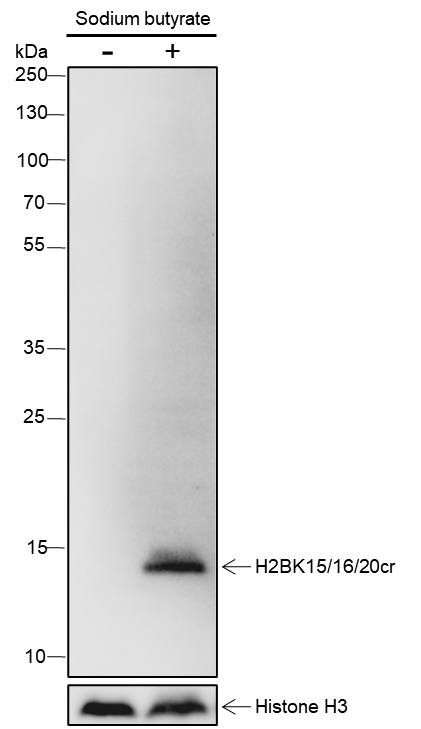 Anti-Crotonyl-Histone H2B (Lys15/16/20) Rabbit mAb