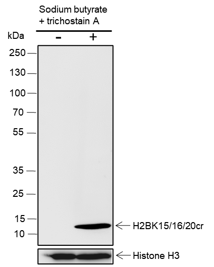 Anti-Crotonyl-Histone H2B (Lys15/16/20) Rabbit mAb