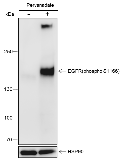 Anti-Phospho-EGFR (Ser1166) Rabbit pAb
