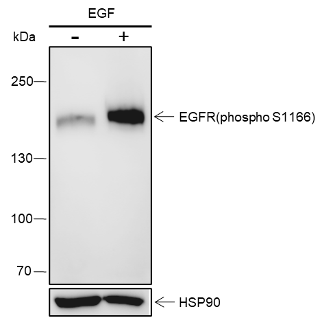 Anti-Phospho-EGFR (Ser1166) Rabbit pAb