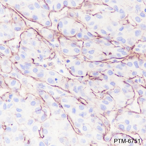 Anti-Glypican 3 Rabbit mAb